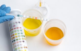 Top Strategies for Hiding Synthetic Urine During a Test