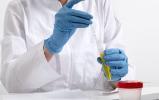 How to Choose the Best Artificial Urine for Lab Tests