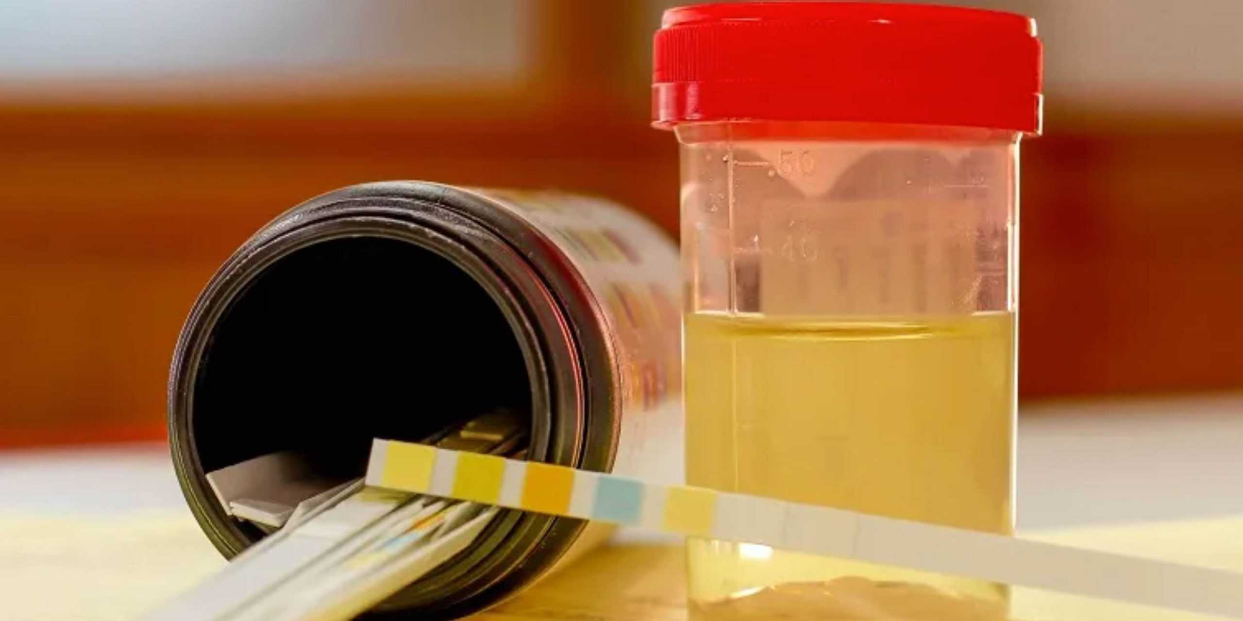 Synthetic Urine